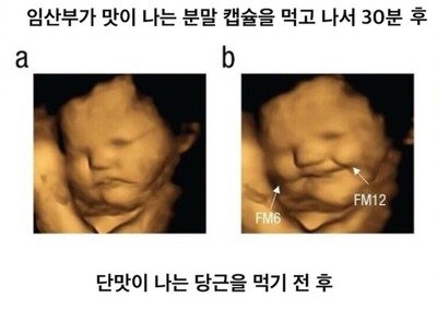 썸네일-임산부가 입덧을 하는 이유-이미지