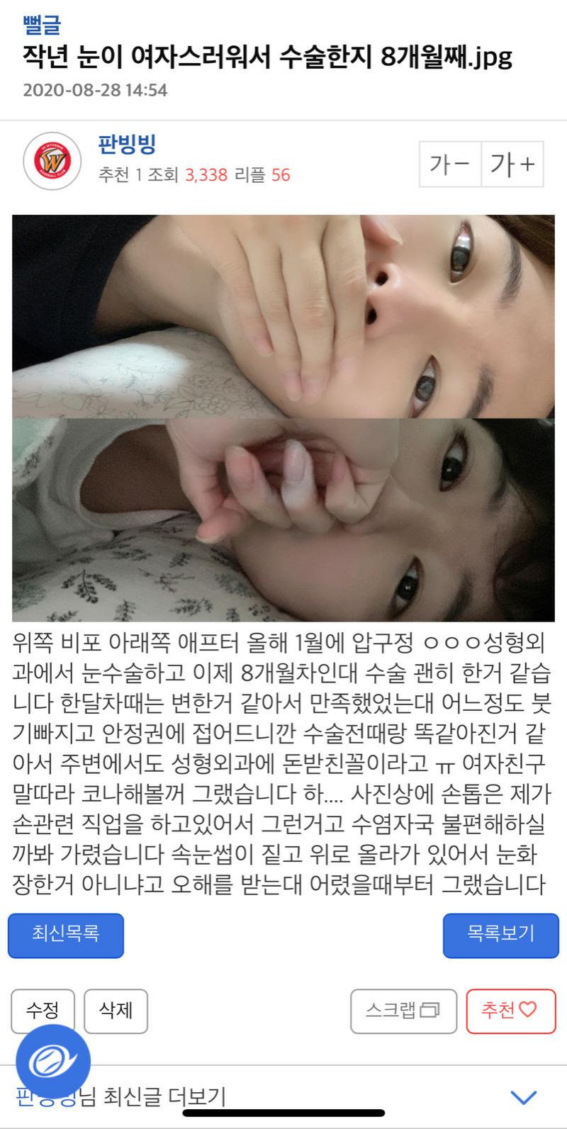 눈이 여자 같아서 수술한 후기 - 에누리 쇼핑지식 자유게시판