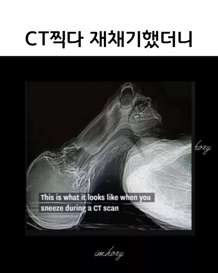 썸네일-CT찍다 재채기했더니-이미지