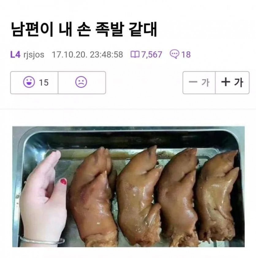 썸네일-남편이 내 손보고 족발같대-이미지