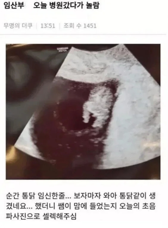 통닭 임신 | 인스티즈