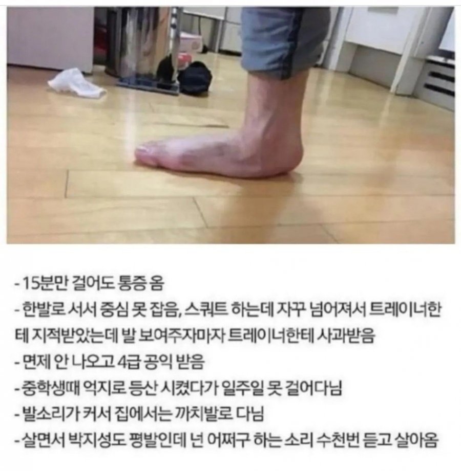 역대급 평발 | 인스티즈